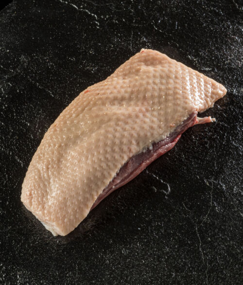 Breast